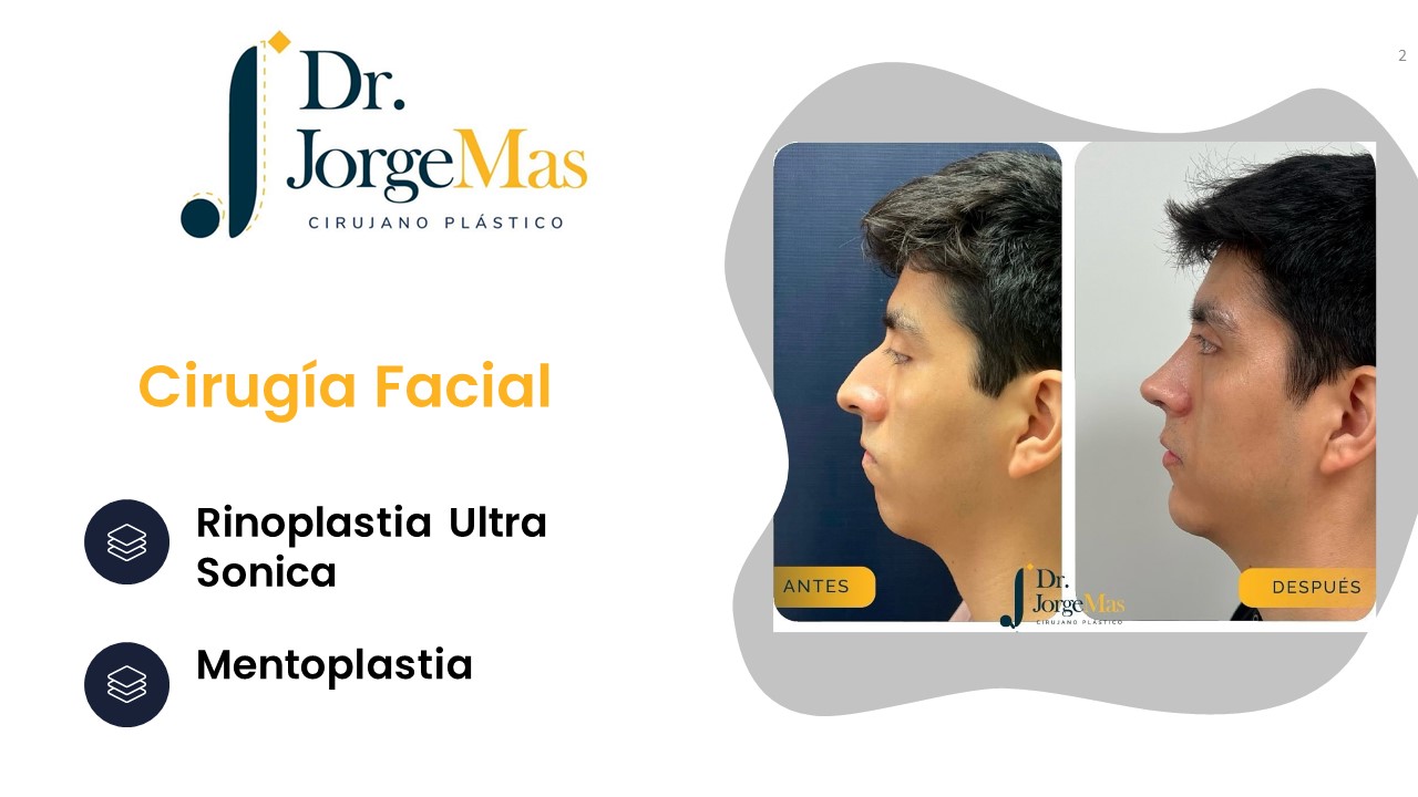 Diapositiva2