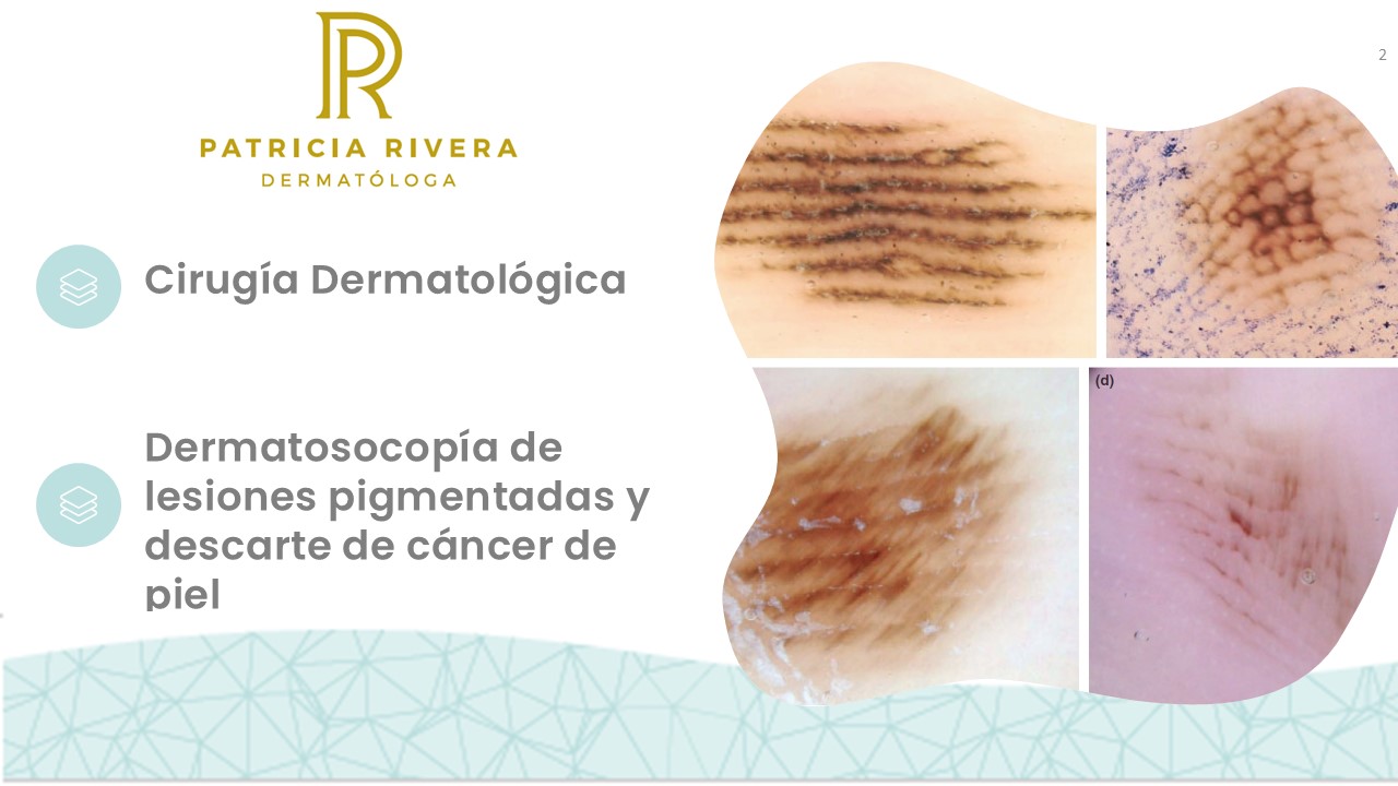 Diapositiva2