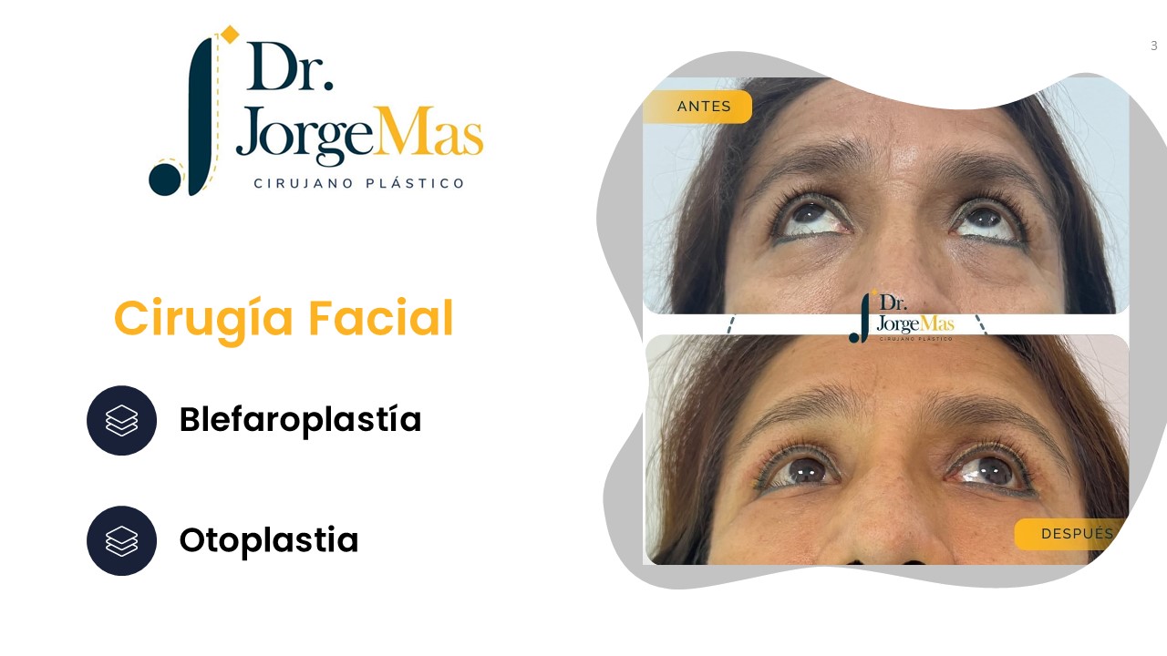 Diapositiva3