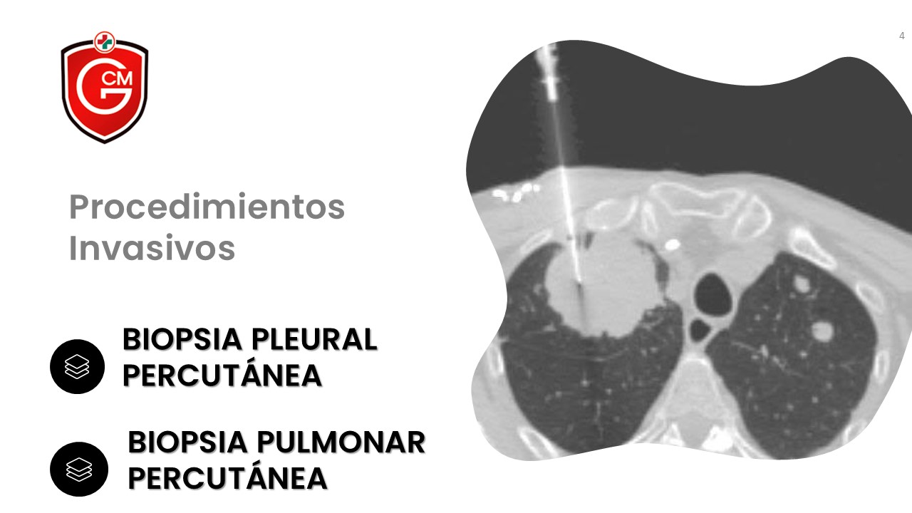 Diapositiva4