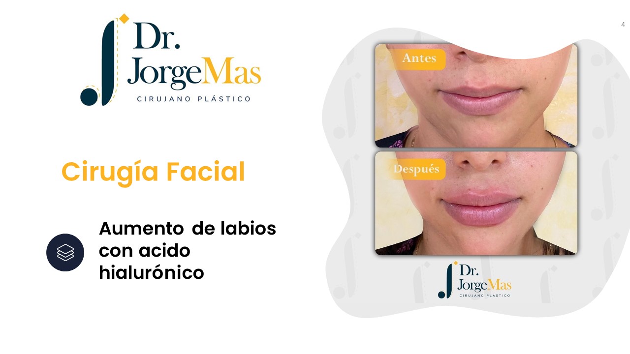 Diapositiva4