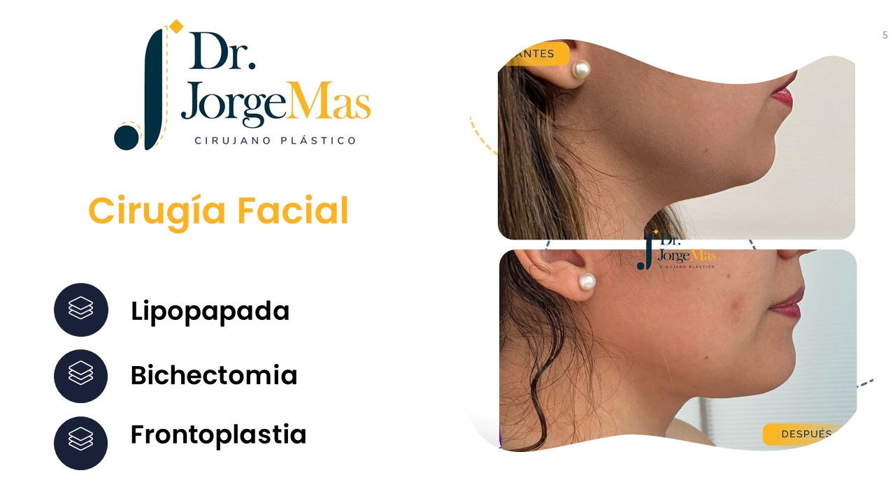 Diapositiva5
