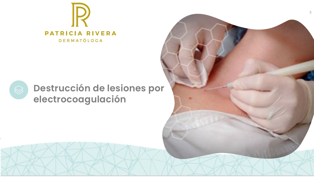 Diapositiva5