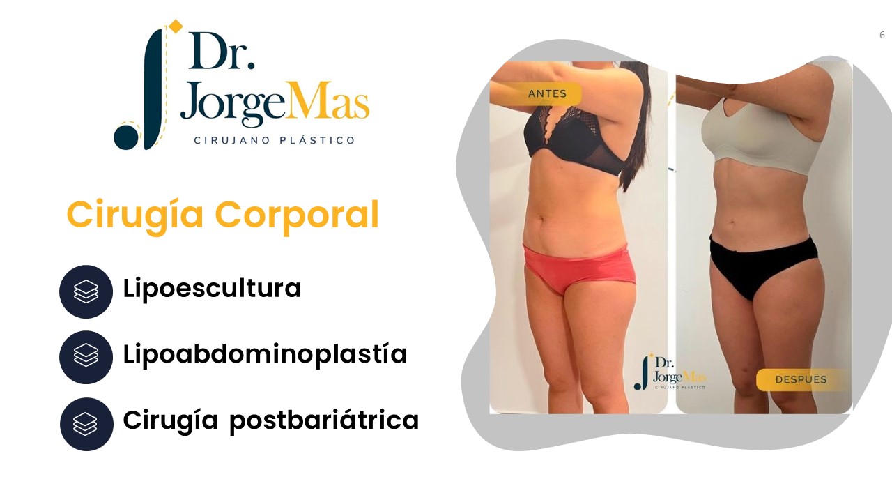 Diapositiva6