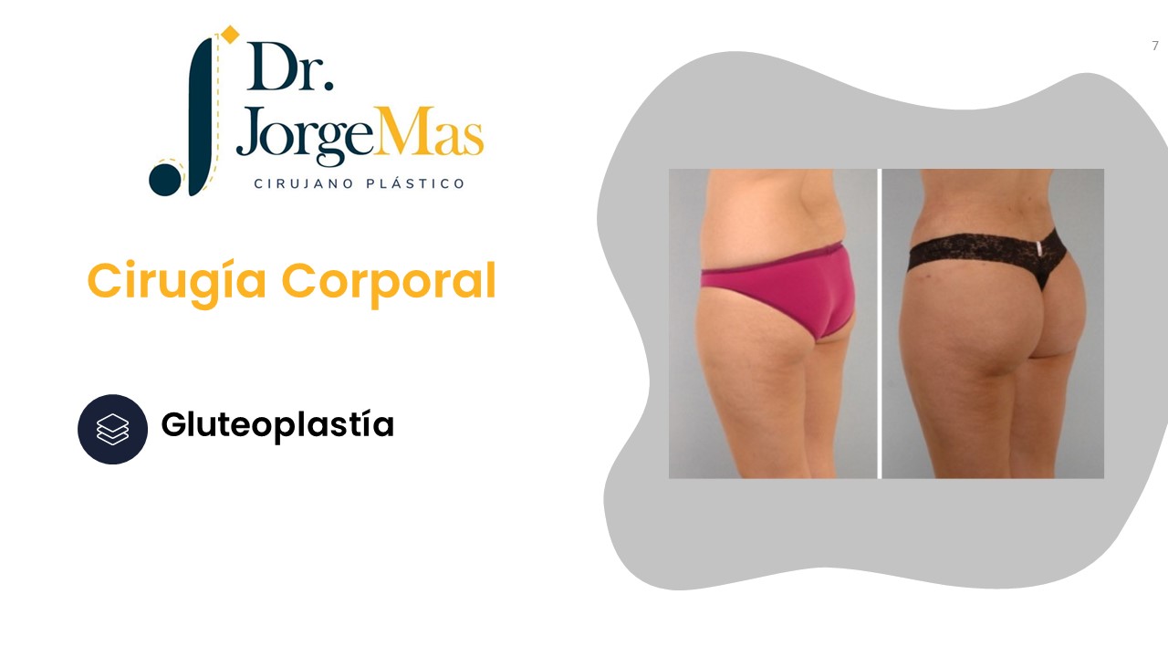 Diapositiva7
