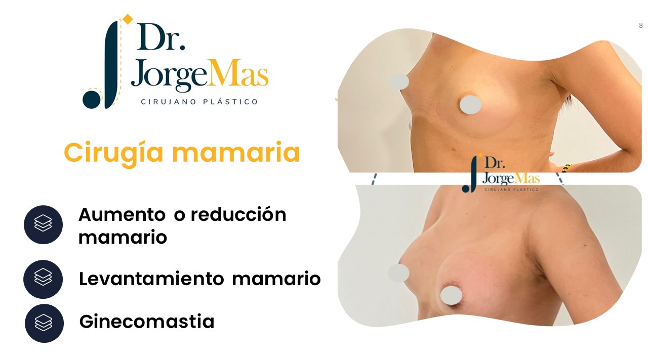 Diapositiva8