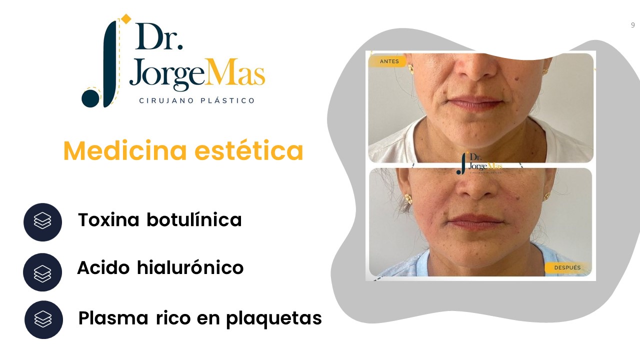 Diapositiva9