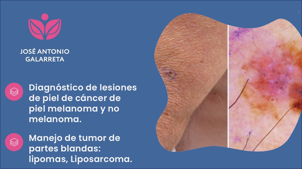 Diapositiva3