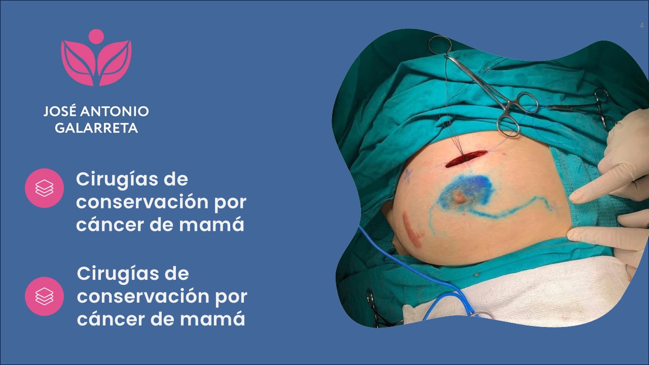 Diapositiva4