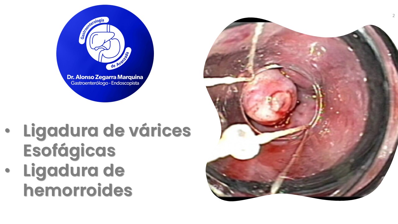Diapositiva2