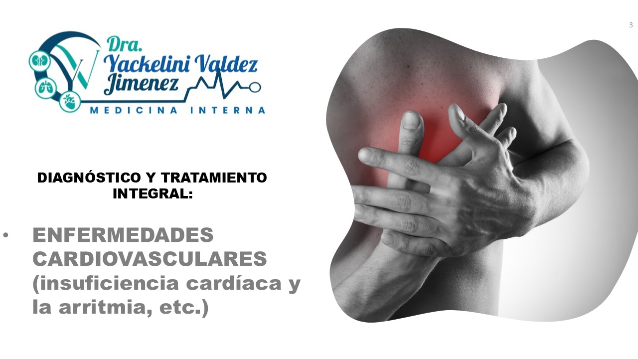 Diapositiva3