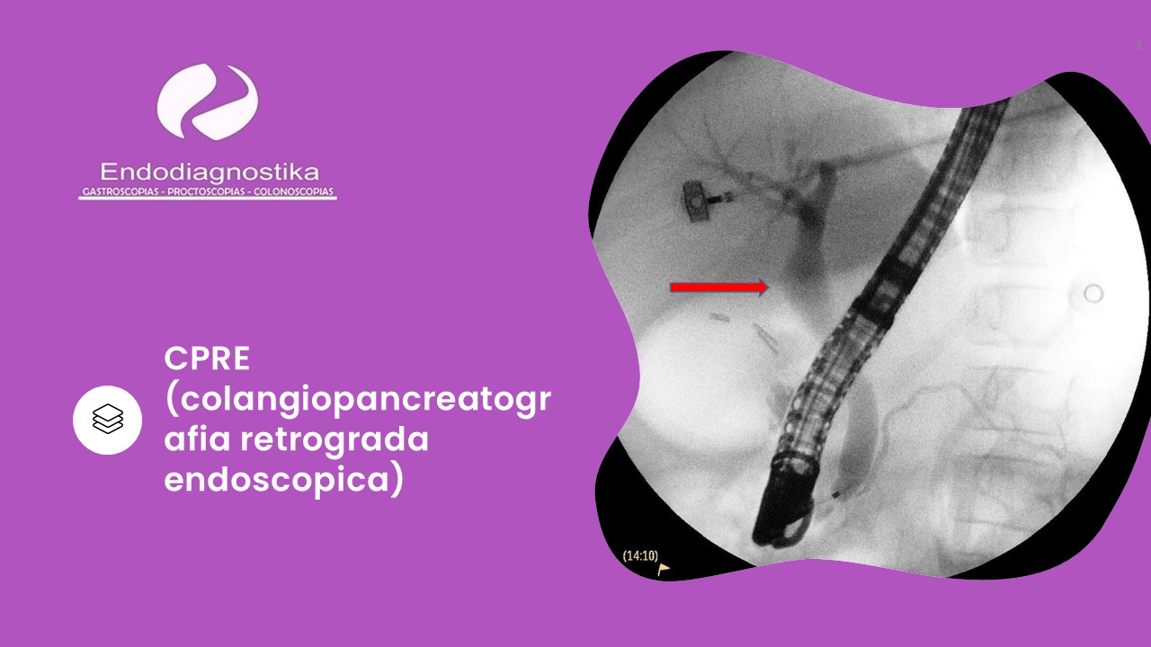 Diapositiva3