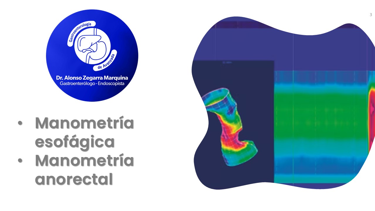 Diapositiva3
