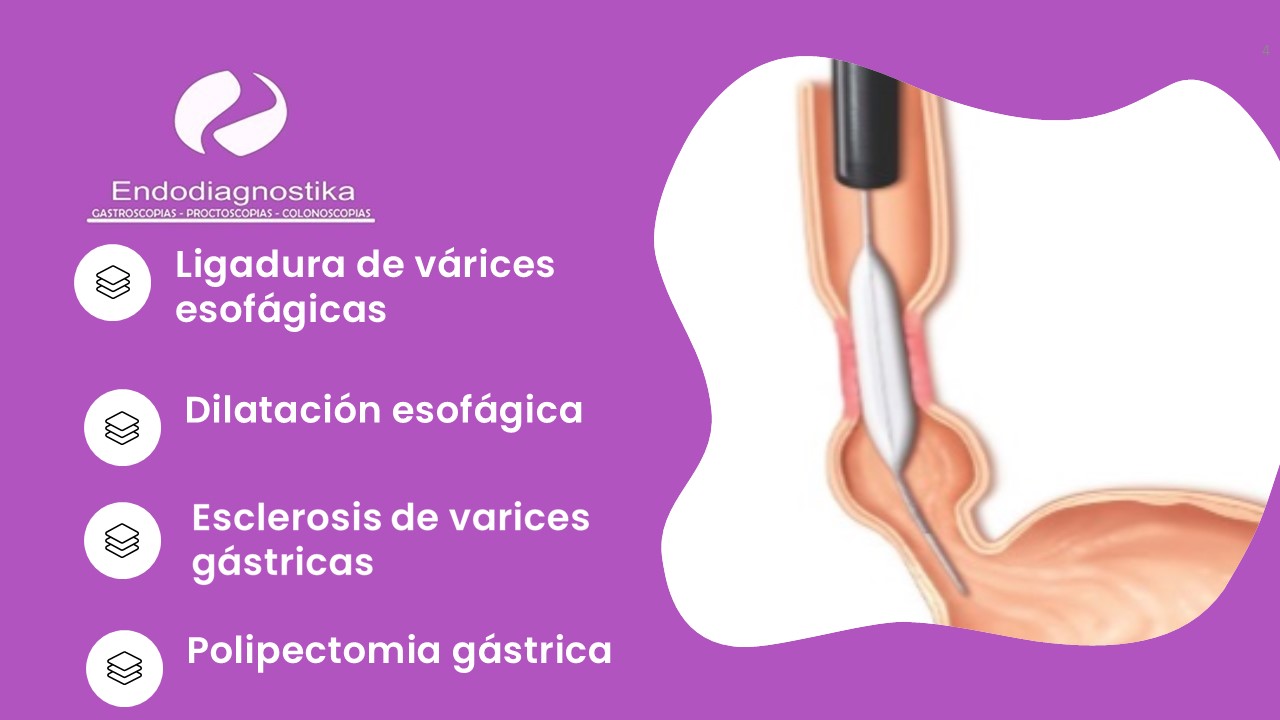 Diapositiva4
