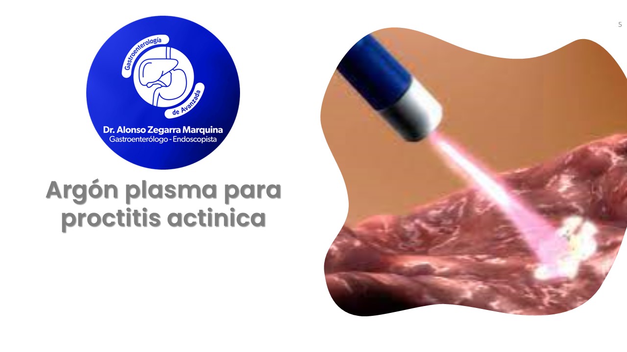 Diapositiva5