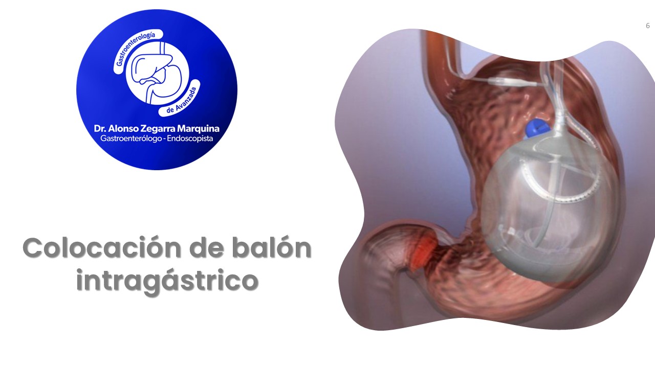 Diapositiva6