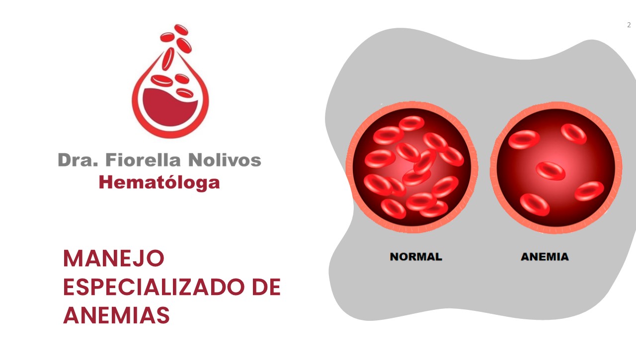 Diapositiva2