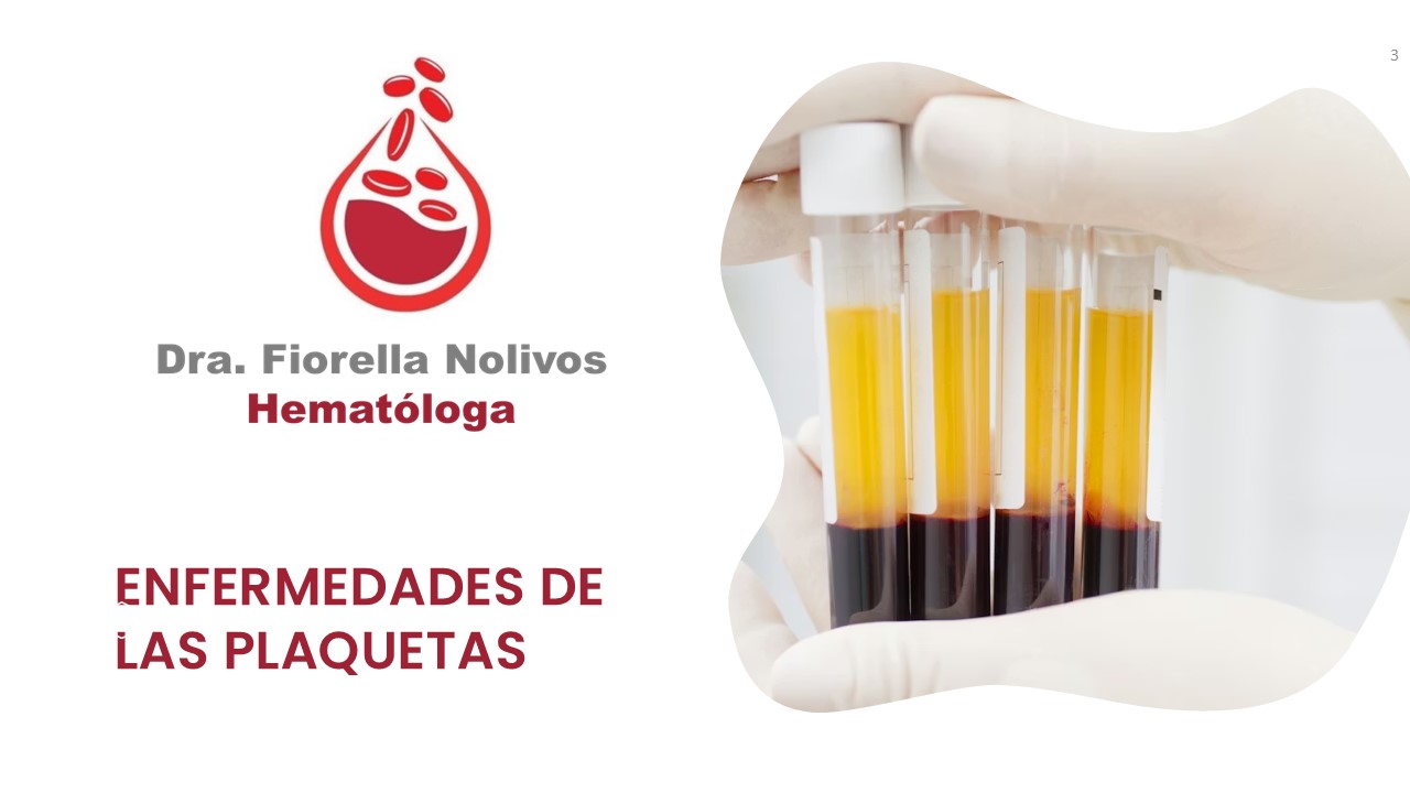 Diapositiva3