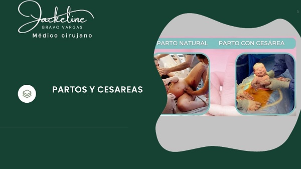 Diapositiva3
